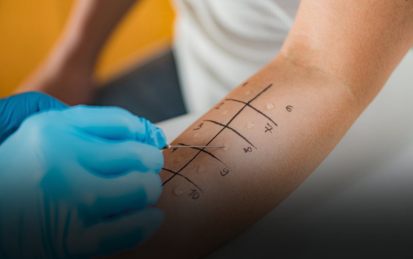 Potential allergic reactions to nitrile gloves Nitrile Gloves Info