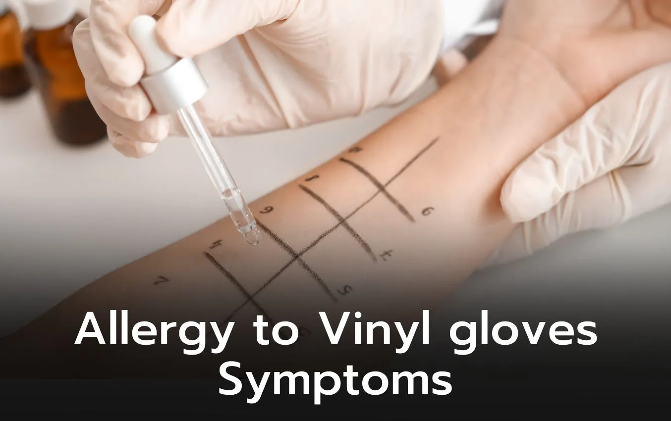 allergy to vinyl gloves symptoms Nitrile Gloves Info
