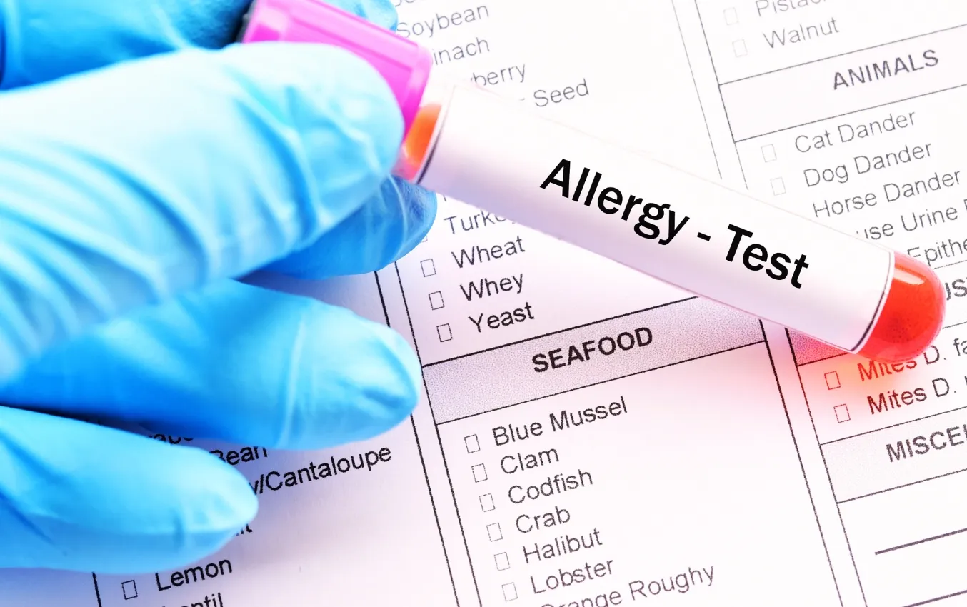 Can you have an allergic reaction to nitrile gloves? Nitrile Gloves Info